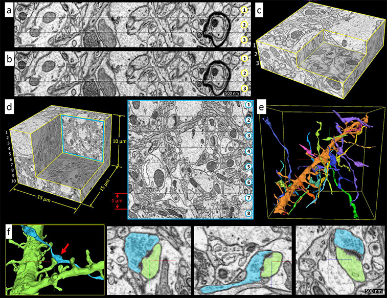 Figure detailing results achieved using GCIB SEM, by Hayworth et al
